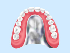 保険の入れ歯