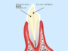 白い歯にかかせない「白い土台」について